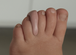 Orthoplastie